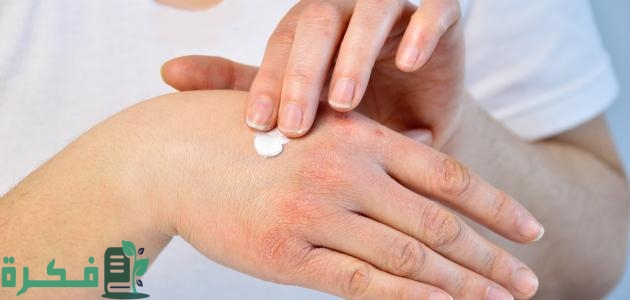 علاج حساسية الجلد من المنظفات 1 علاج حساسية الجلد من المنظفات