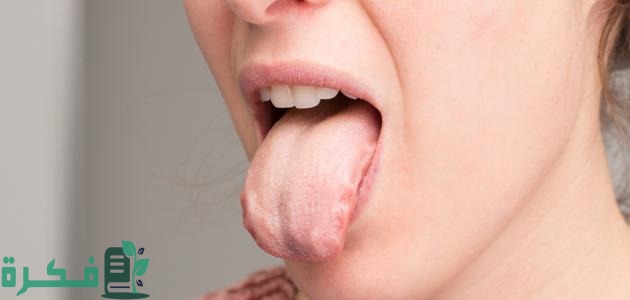 لون اللسان الطبيعي بالصور؛ دلالات تغير لون اللسان 1 لون اللسان الطبيعي بالصور