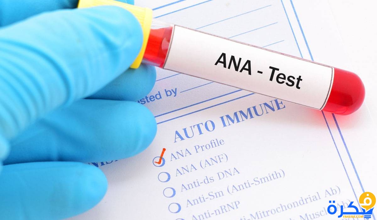 ما هي نسبة فحص ANA 5 تحليل ANA