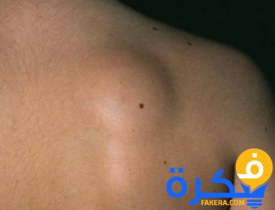 5d6ae1aab00129aae555429f558e5351