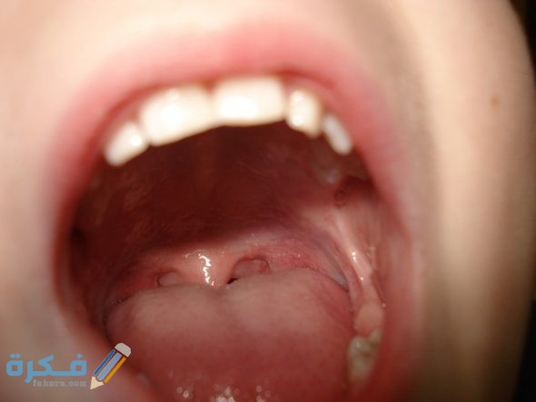 Phlegm stuck in the throat 590x443 1