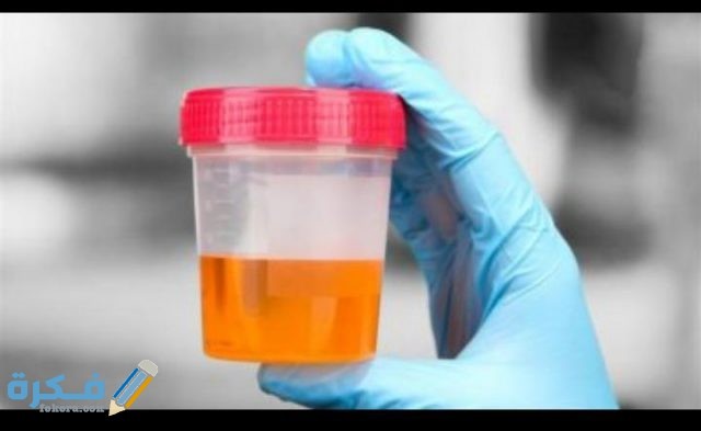 ما معنى mucus في تحليل البول