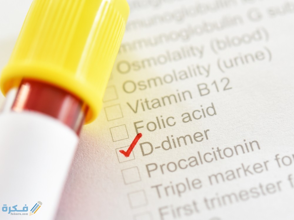 أنا خائف من ارتفاع Di-Dimer هل يرتفع بسبب الحمي أو العدوي؟