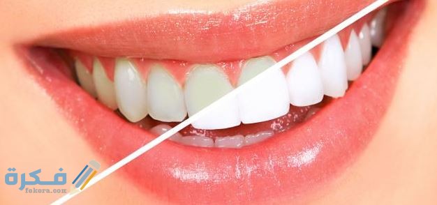 سعر تنظيف الأسنان في مصر سعر تنظيف الأسنان في مصر