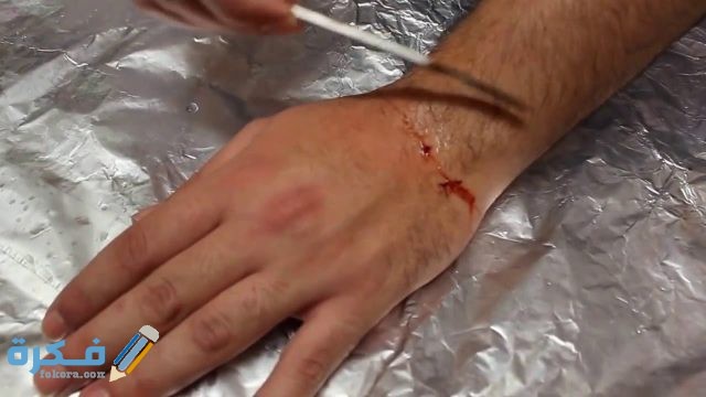  تفسير رؤية قطع الذراع