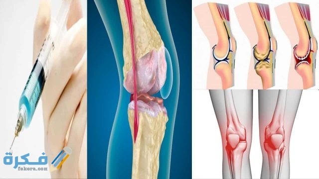 طرق علاج اليرقان او مرض بوصفير