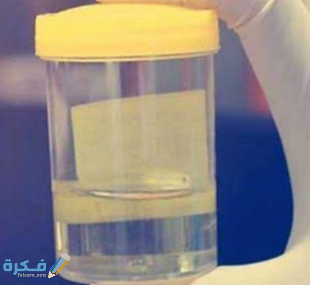 Запах мочи. Ацетон в моче. Прозрачная моча. Бледная моча. Светлая моча.