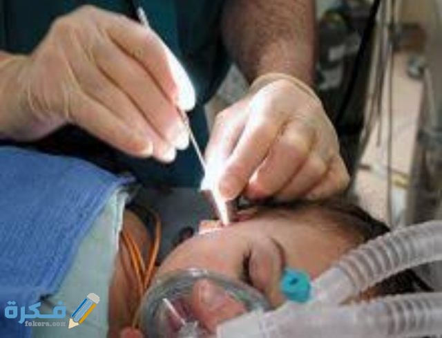 تجربتي مع تنسيم الرأس وأسباب الإصابة بالمرض