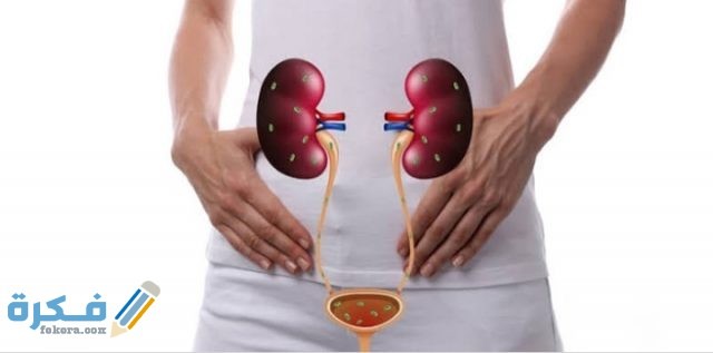 هَلْ أملاح الكلى تسبب فشل كلوي؟