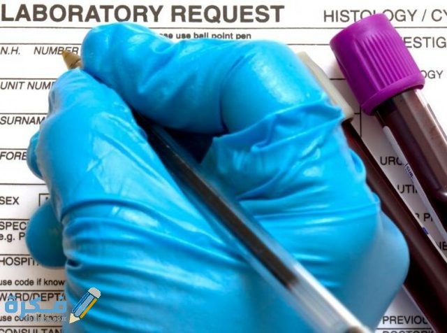 تحليل monocytes المعدل الطبيعي