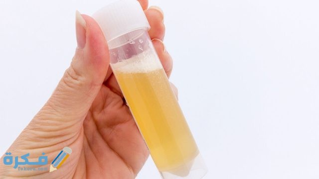 إجراءات إجراء تحليل البول 