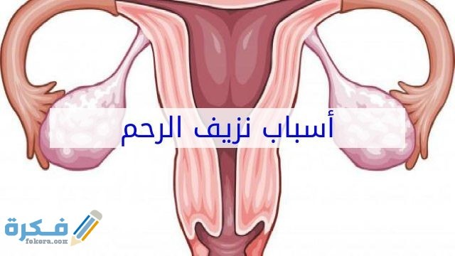 أسباب نزيف الدورة الشهرية 