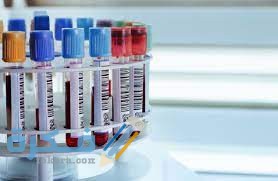 ما هو تحليل alkaline phosphatase