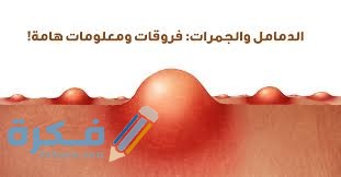 ماسبب ظهور حبوب المؤخرة