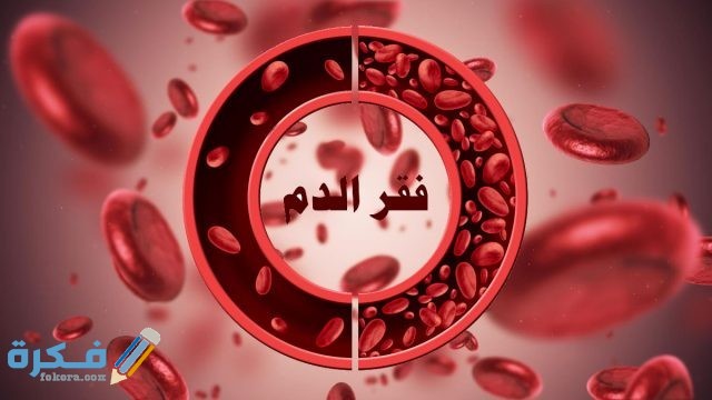 مفهوم فقر الدم 