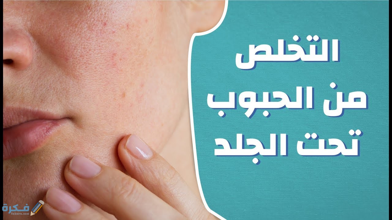 اسباب ظهور الحبوب تحت الجلد