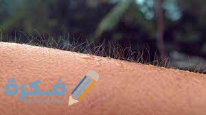  ما هو جلد الوزة 