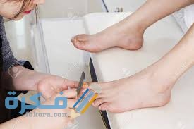استئصال عين السمكه جراحيا 