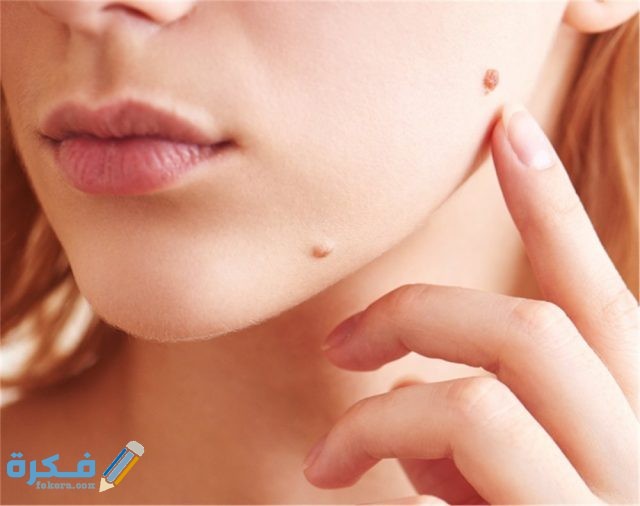 طريقة التخلص من ثاليل الوجه