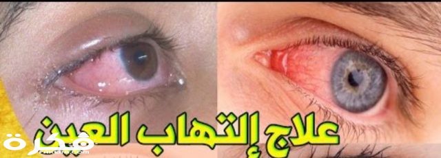 IMG ٢٠٢٠٠٤٠٥ ٠٦٢٧٣٣