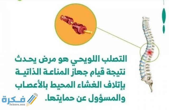 ما هو مرض التصلب اللويحي ما هو مرض التصلب اللويحي