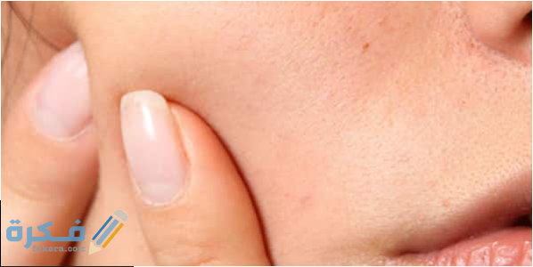 طرق الوقاية من نمو الحبوب تحت الجلد 