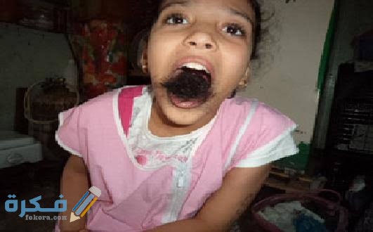 تفسير حلم سحب الشعر من اللسان 