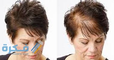 تفسير رؤية الشعر الخفيف تفسير رؤية الشعر الخفيف