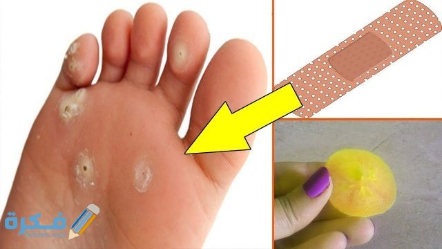 استخدام اللاصقة الطبية 