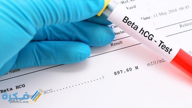 طريقة قراءة تحليل البول للحامل