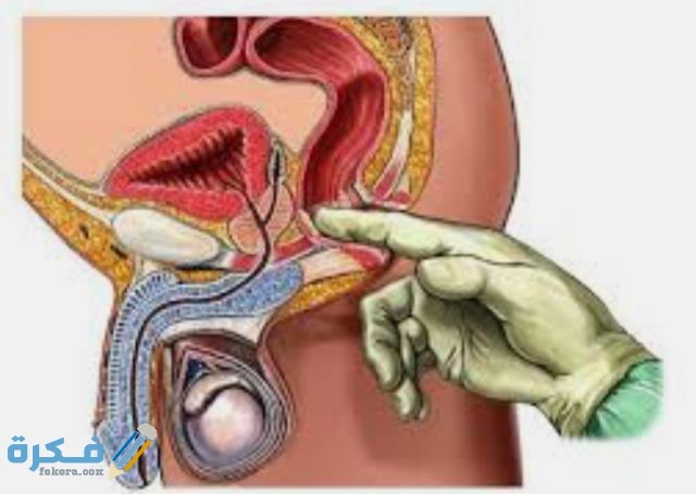 اقوى مضاد حيوي لعلاج التهاب البروستاتا