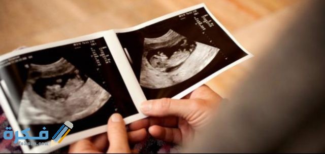 كيفية معرفة نوع الجنين من الشهر الاول