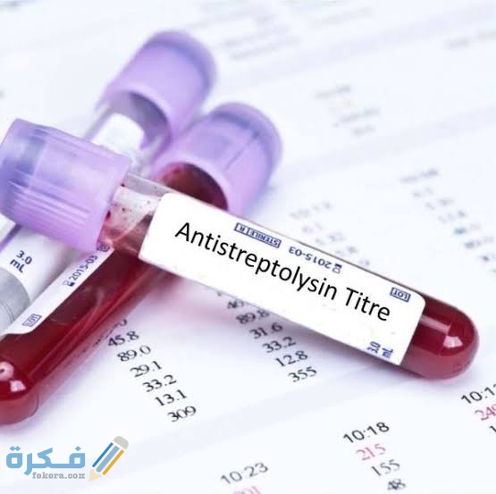تحليل ASOT : المعدل المرتفع ، والعلاج الفعال