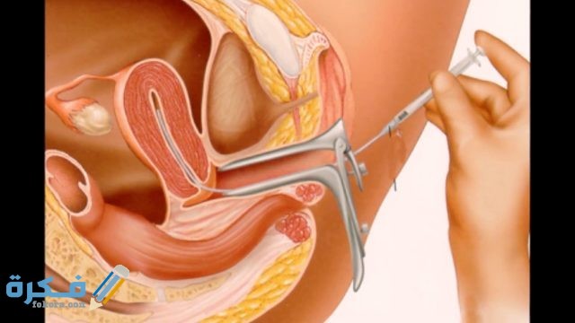 افرازات تدل على نجاح التلقيح الصناعي