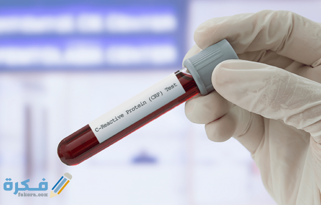 أسعار تحليل crp