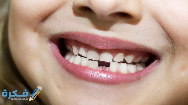 تفسير حلم رؤية سقوط الاسنان