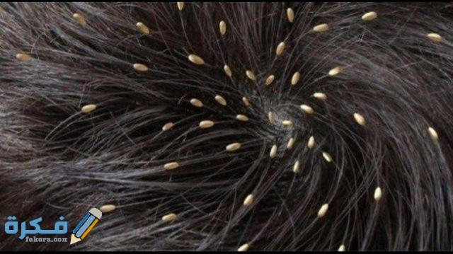 تفسير رؤية القمل تفسير رؤية القمل