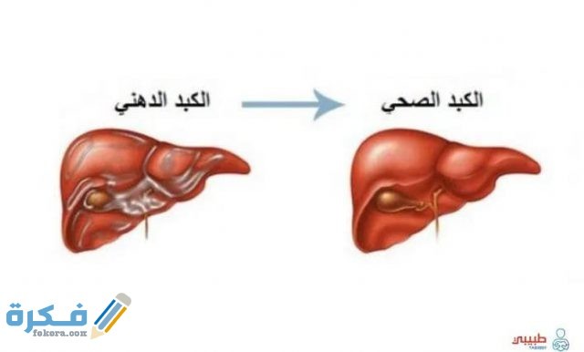 كم نسبة دهون الكبد الطبيعية
