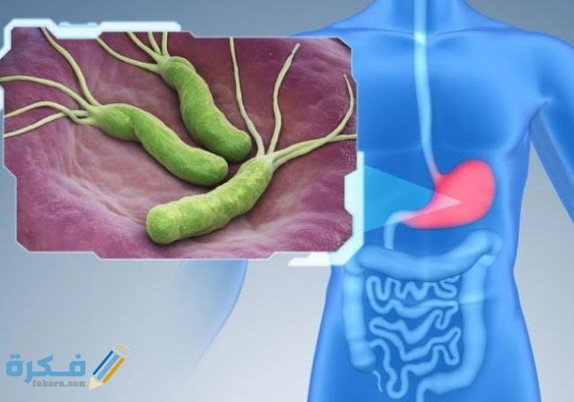 كم نسبة جرثومة المعدة الخطيرة