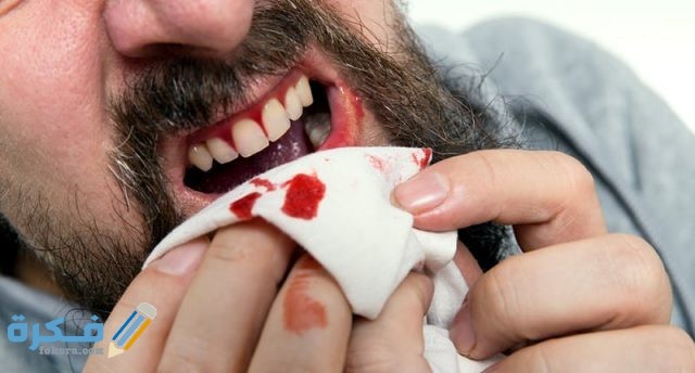 Bleeding Gums