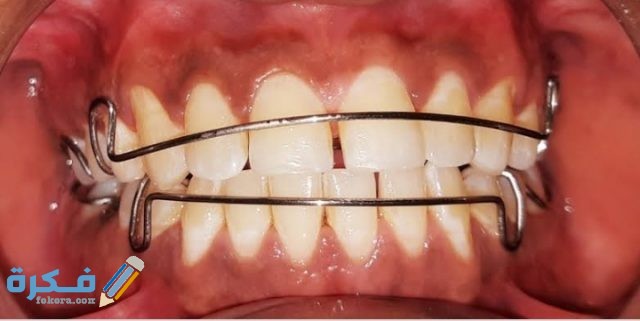 IMG ٢٠٢٠١٠٠٢ ٠٧١٦٢٣