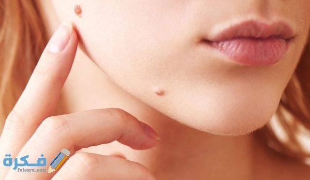 تفسير رؤية شامات على الجسم