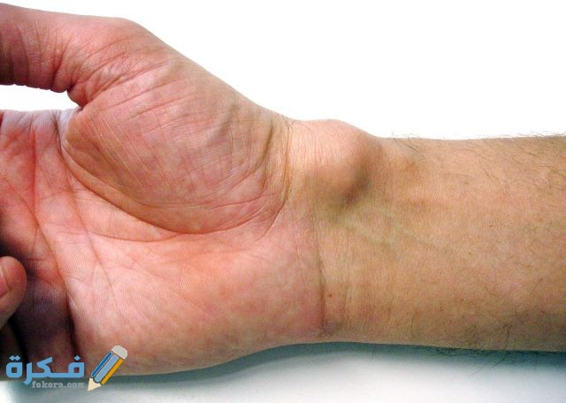 تفسير رؤية ورم في الرقبة