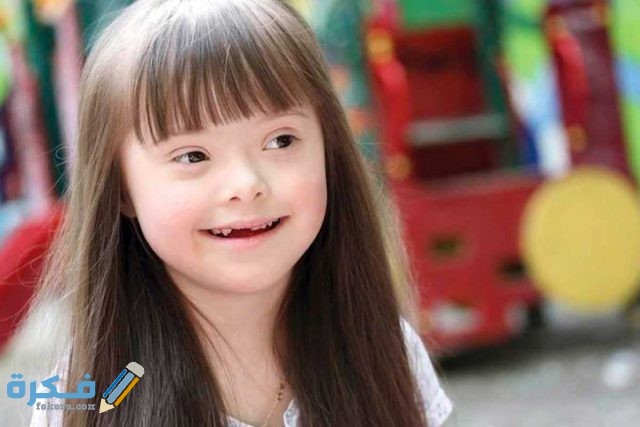 تفسير رؤية طفل متلازمة داون في المنام 