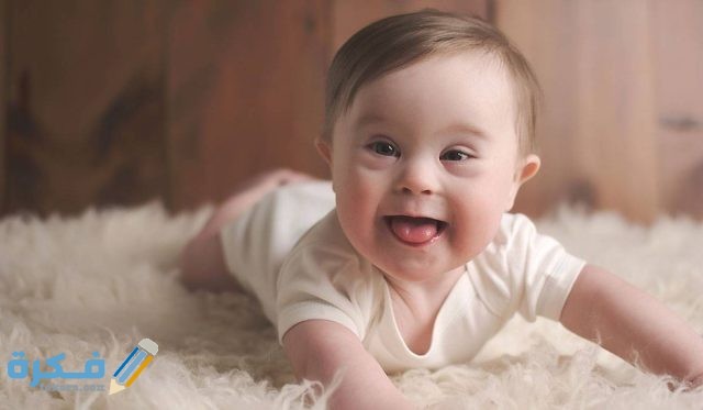 تفسير رؤية طفل متلازمة داون في المنام 