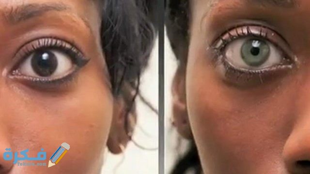 تفسير رؤية تغير لون العين في المنام