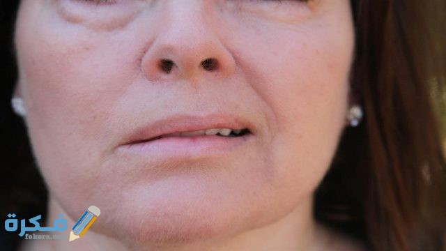 تفسير رؤية الفم المعوج في المنام