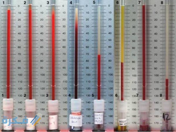 ما هي سرعة الترسيب في الدم