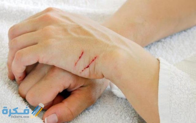 تفسير رؤية خدش القطة في المنام