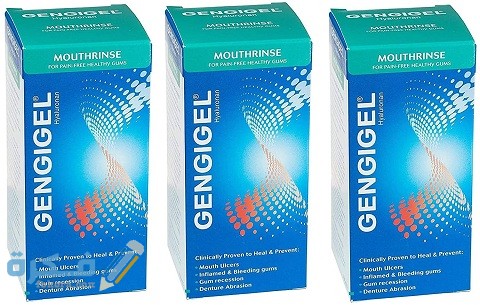 جينجيجيل Gengigel